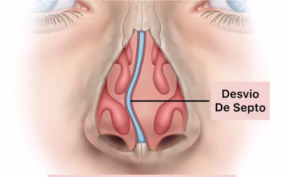 Costuma Ressonar? Conheça as Causas e os Tratamentos Disponíveis
