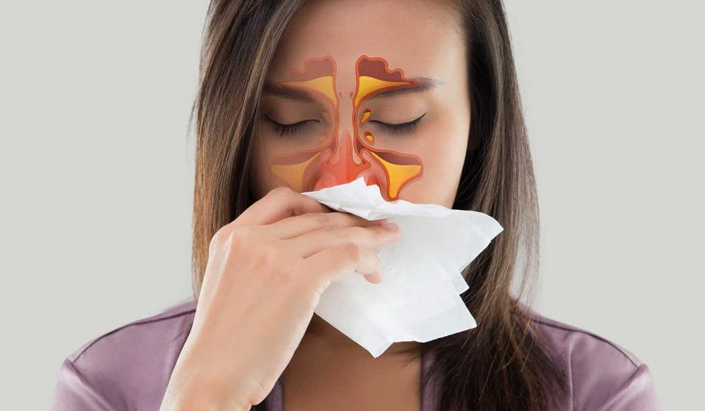congestão nasal - nasalhelper